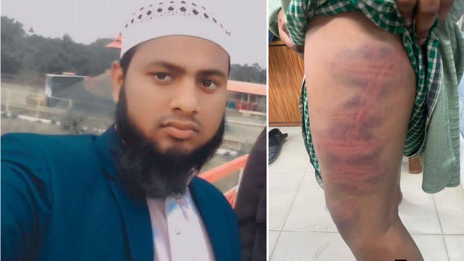 পাবনায় মাদ্রাসার এতিম ছাত্রকে নির্মম ভাবে মারধোরের অভিযোগ শিক্ষকের বিরুদ্ধে