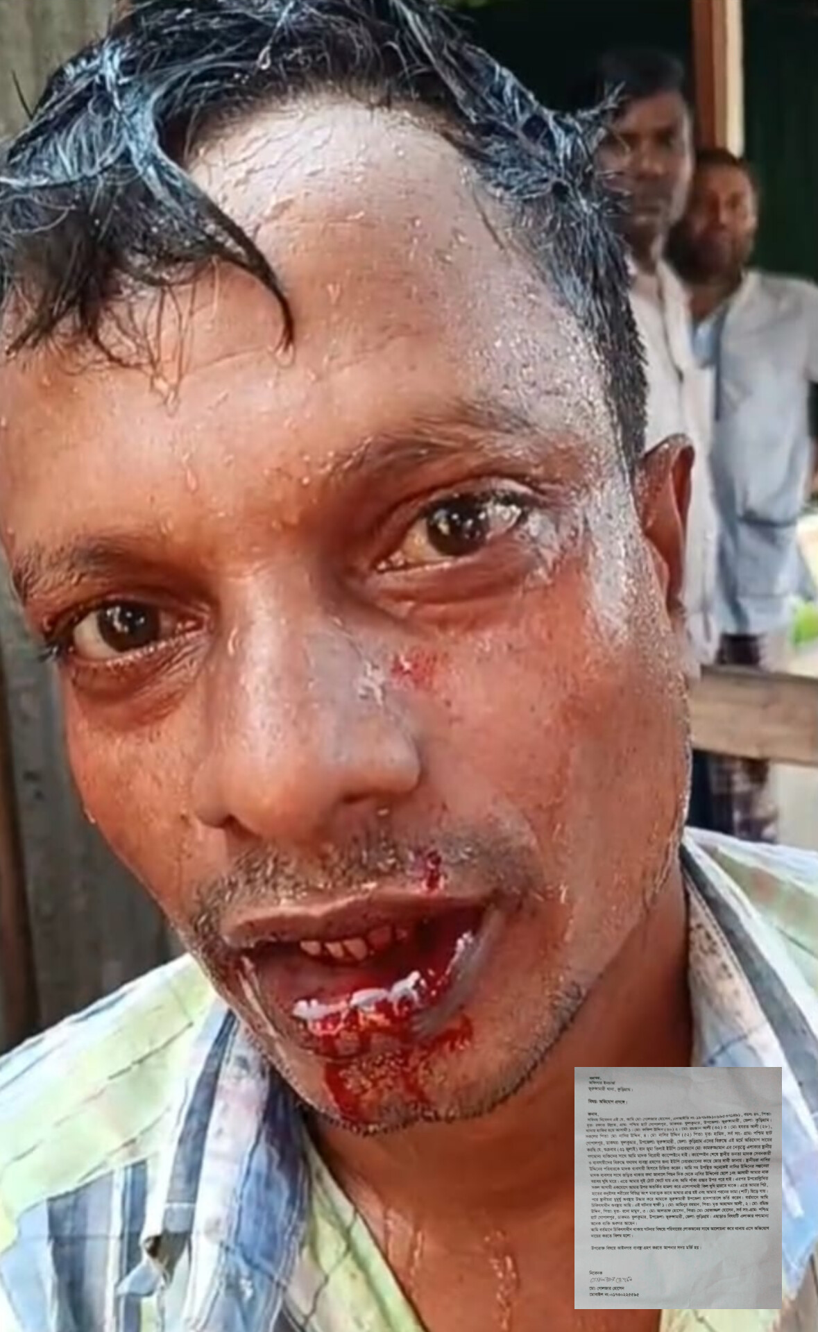 ভূরুঙ্গামারীতে মাদকবিরোধী ক্যাম্পেইনে হামলা, আহত ১; চারজনের বিরুদ্ধে অভিযোগ 