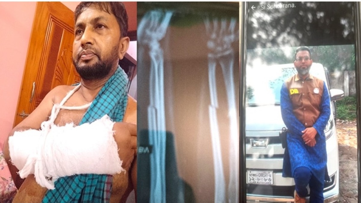 মনোহরদীতে শিক্ষককে লোহার পাইপ দিয়ে মারধরের অভিযোগ  এএসআইয়ের বিরুদ্ধে মামলা, ক্ষোভে উত্তাল মনোহরদী