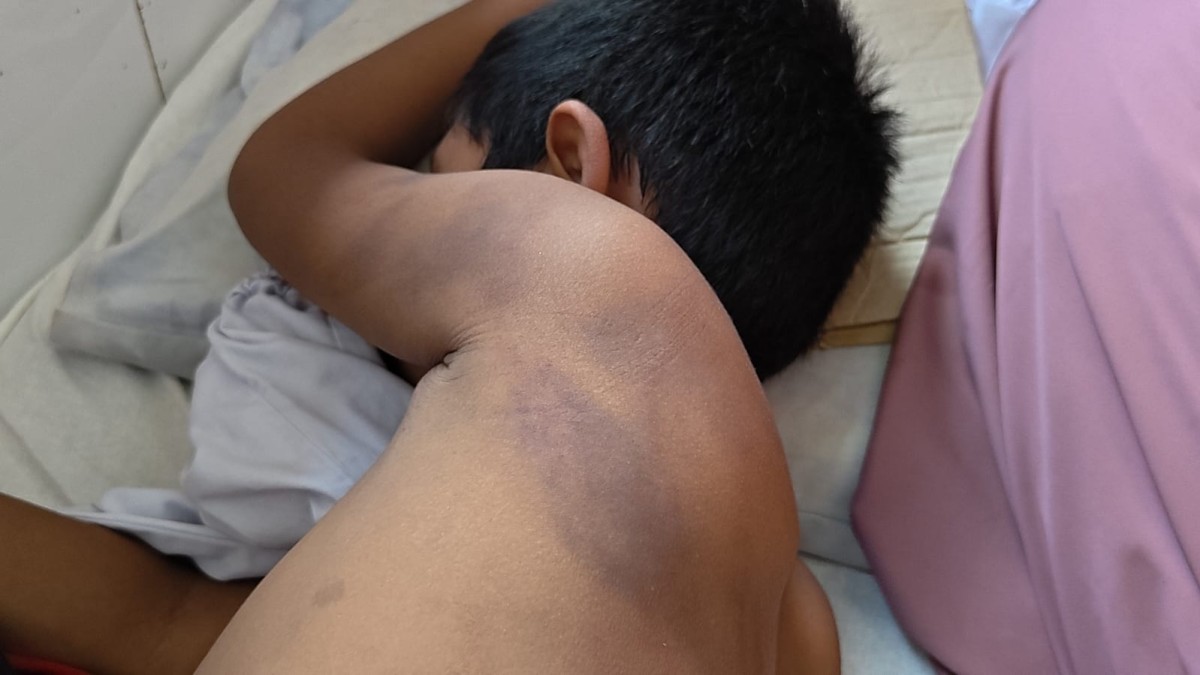 বাগেরহাটের শরণখোলায় এক মাদ্রাসার ছাত্রকে গুরুতর মারধরের অভিযোগ শিক্ষকের বিরুদ্ধে