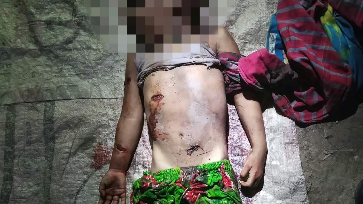 বদলগাছীতে শিয়ালের তাড়া খেয়ে পাওয়ার টিলারে পিষ্ট হয়ে শিশুর মৃত্যু